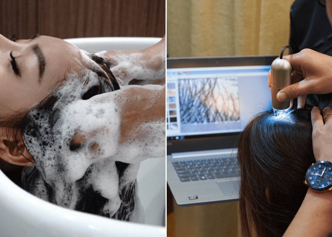 Empire Charme’s Ginseng Scalp Therapy | Hair treatment and services