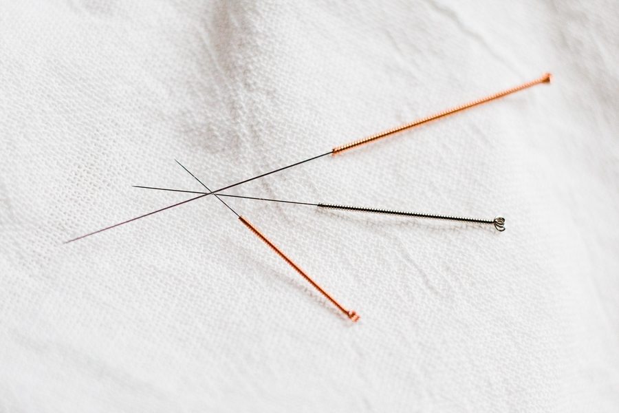 where-to-get-Acupuncture in Hong Kong Dr. Susan Jamieson Integrative Medical Practice